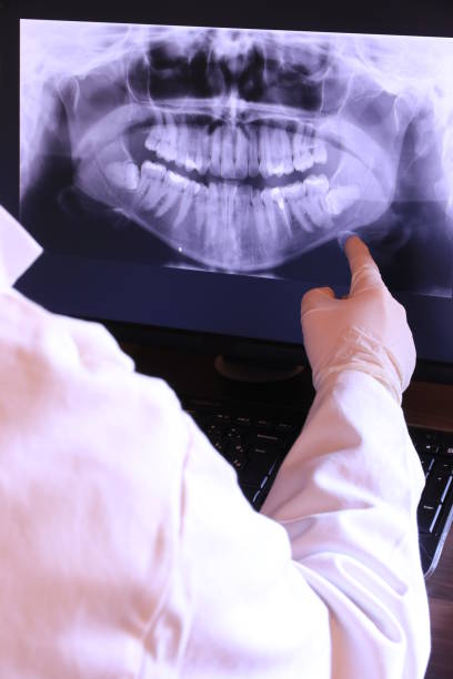Best Emergency Dental Filling Replacement  in Olmsted Falls, OH